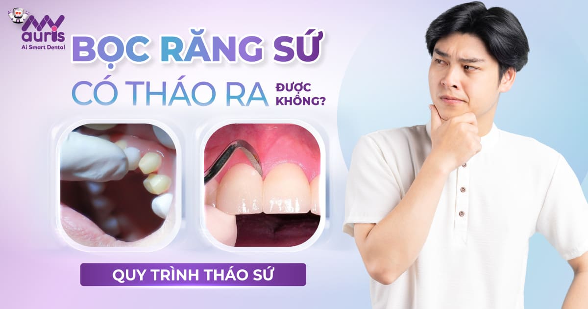 bọc răng sứ có tháo ra được không