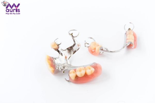 Các phương pháp trồng răng hàm an toàn - Hàm giả tháo lắp