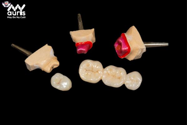 Phương pháp trồng răng Titan là kỹ thuật gì?
