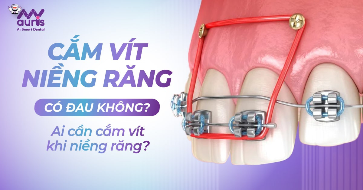 cam-vit-nieng-rang-co-dau-khong-ai-can-cam-vit