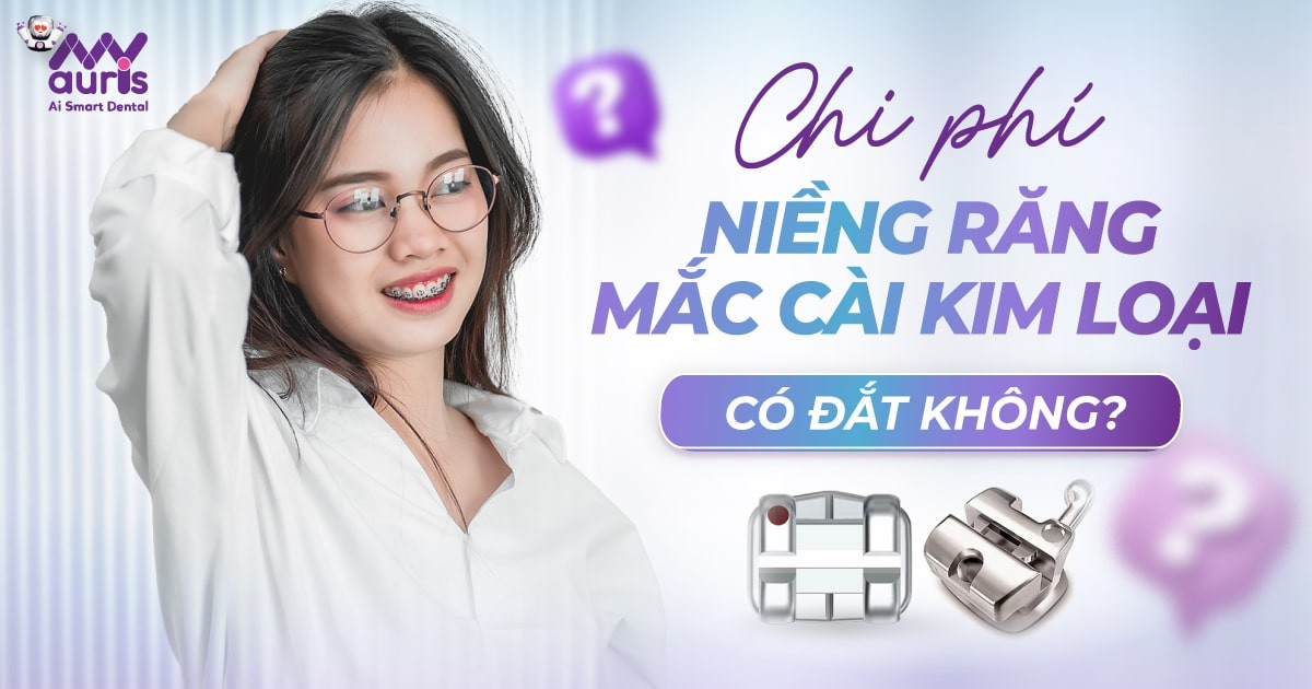 Chi phí niềng răng mắc cài kim loại có đắt không?