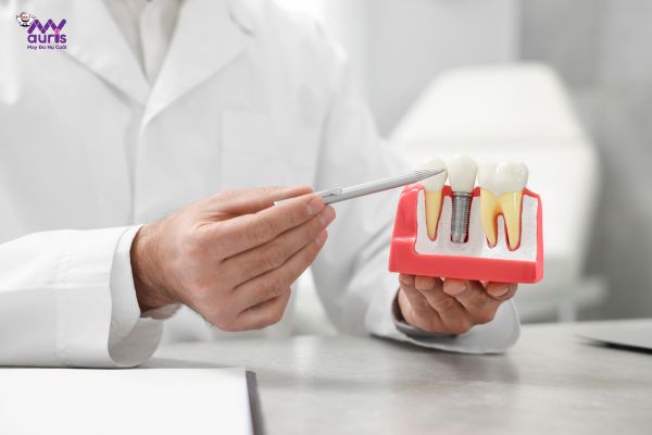 Giá cấy răng implant như thế nào?