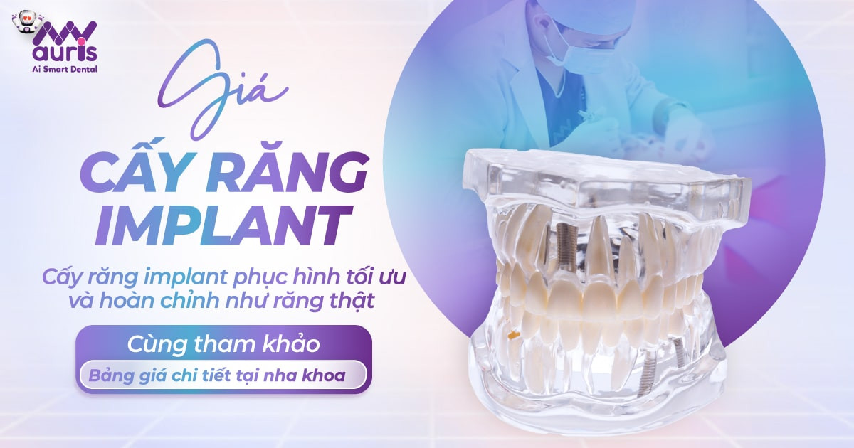 Giá cấy răng implant