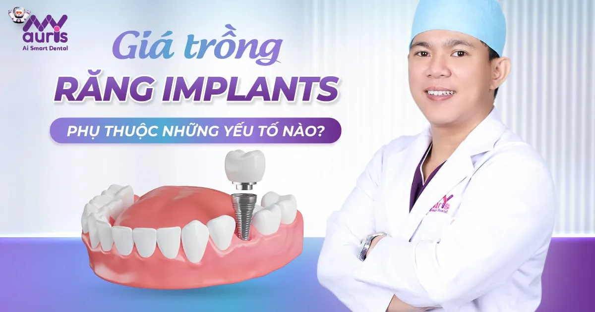 Giá trồng răng implants phụ thuộc những yếu tố nào?