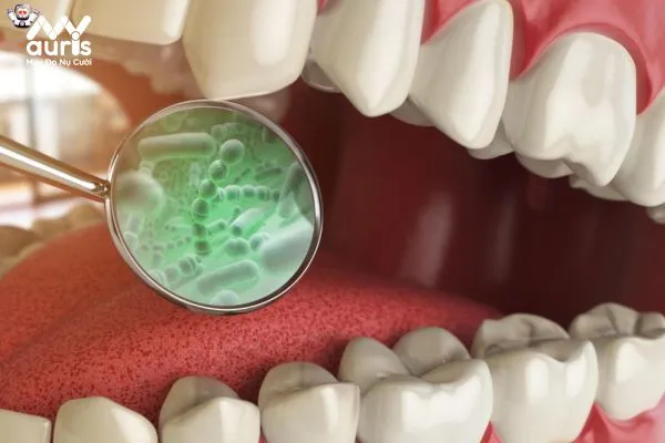 Vì sao làm răng sứ lại bị hôi miệng?