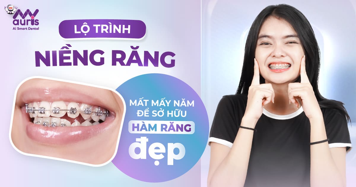 niềng răng mấy năm