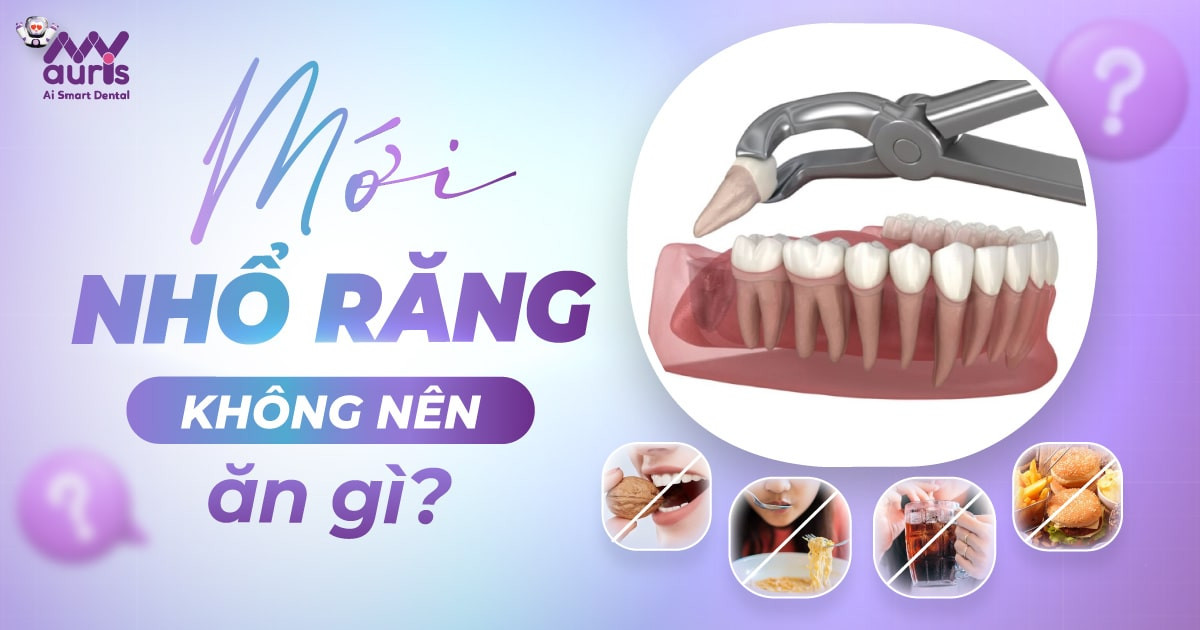 Mới nhổ răng không nên ăn gì? 5 thực phẩm cần tránh xa