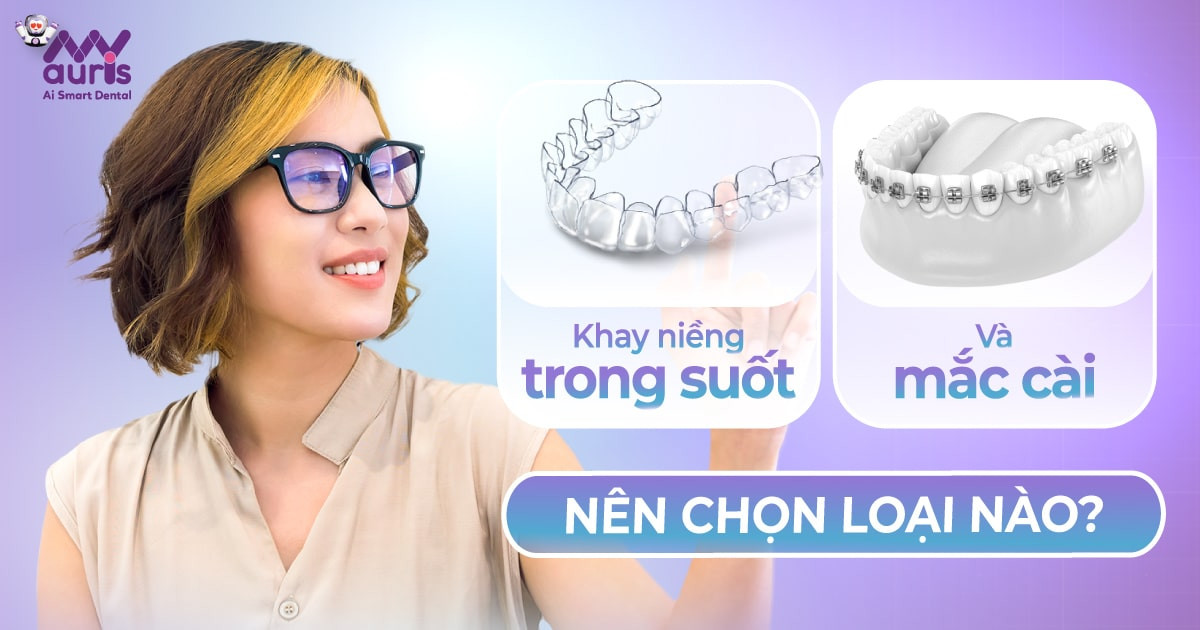 [Hỏi đáp] Nên niềng răng trong suốt hay mắc cài?