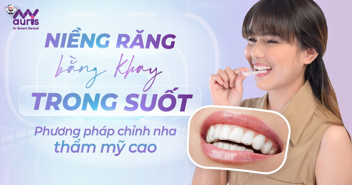 Niềng răng bằng khay trong suốt và những điều cần biết