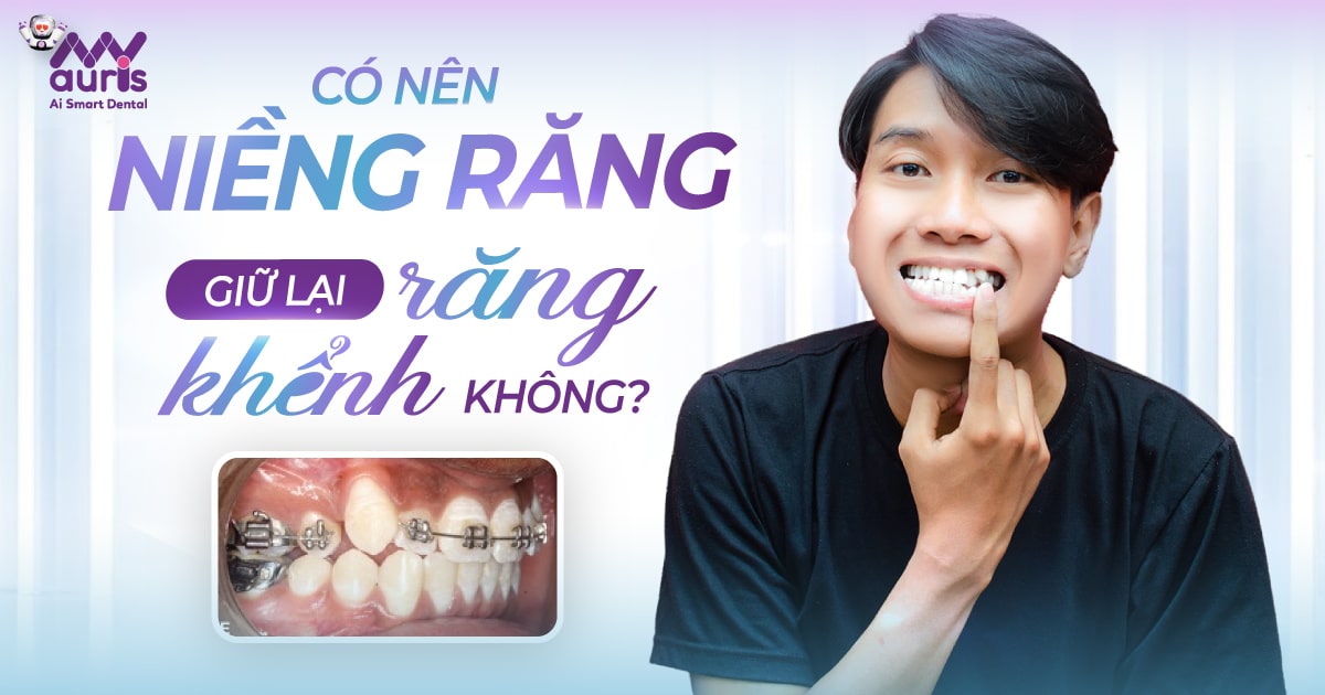 [Giải đáp] Có nên niềng răng giữ lại răng khểnh không?