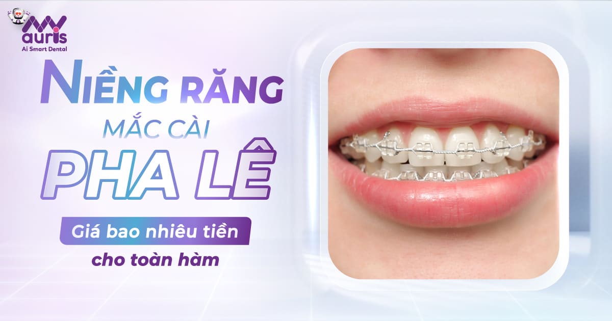 niềng răng mắc cài pha lê giá