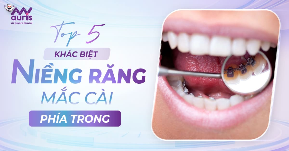 niềng răng mắc cài phía trong