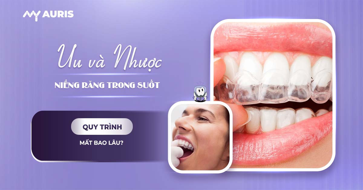 niềng răng trong suốt,niềng trong suốt,niềng răng invisalign có hiệu quả không,niềng răng trong suốt có hiệu quả không,niềng răng trong suốt mất bao lâu,khay niềng trong suốt,niềng răng invisalign nhược điểm