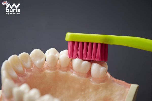 Chăm sóc răng không cẩn thận sẽ dễ làm răng sứ đổi màu 