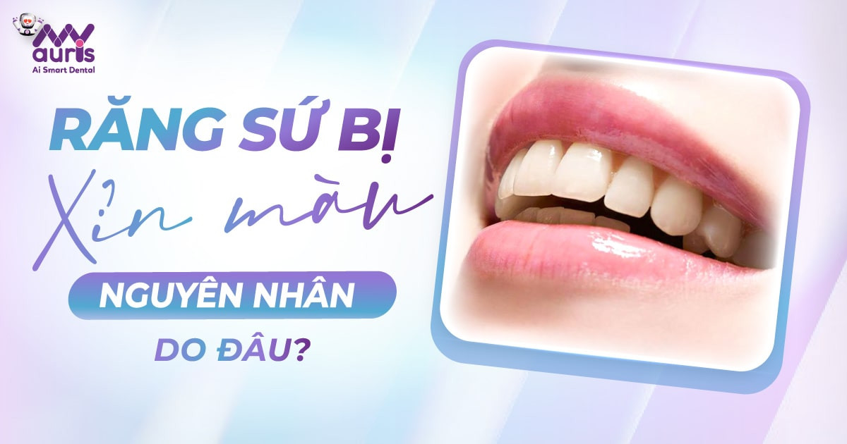 6 nguyên nhân làm răng sứ bị xỉn màu cần lưu ý