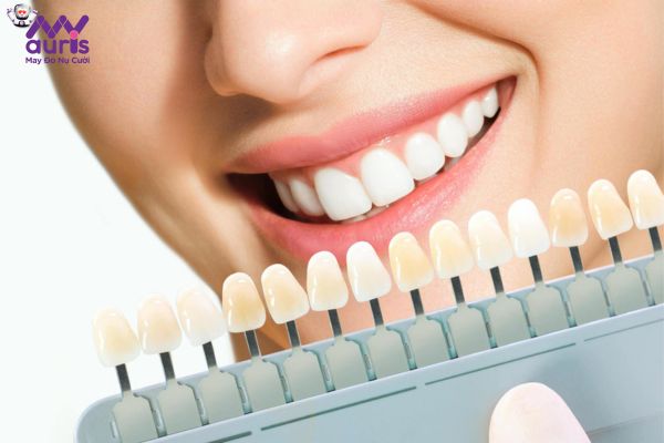 Răng sứ không kim loại là răng gì?