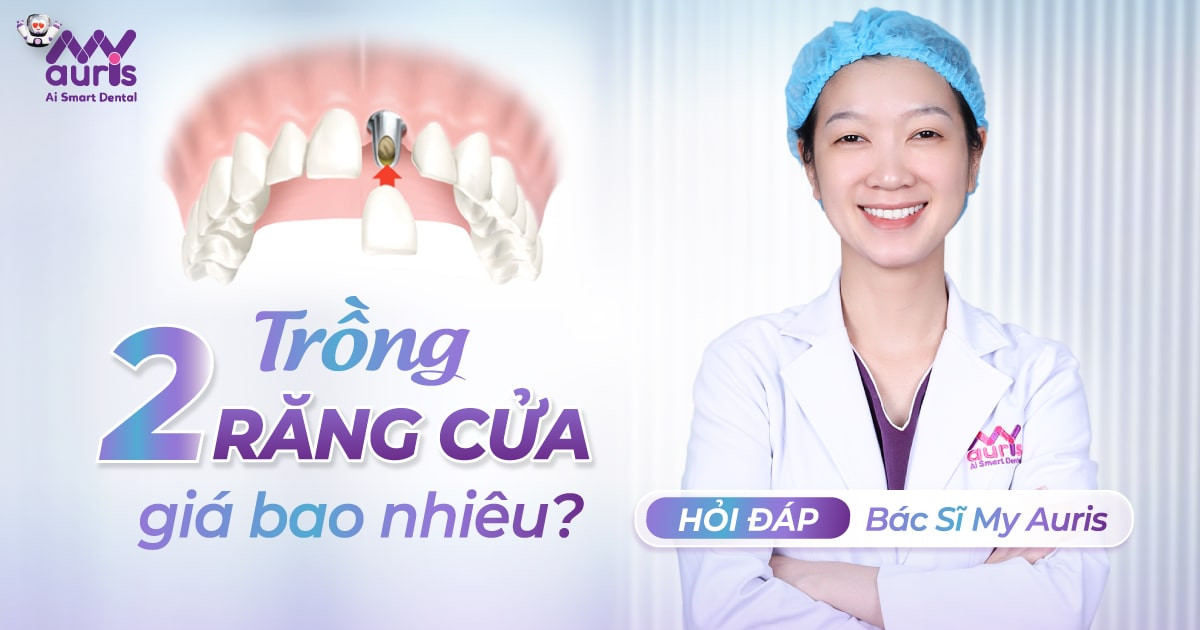 [Hỏi đáp nha khoa] Trồng 2 răng cửa giá bao nhiêu?