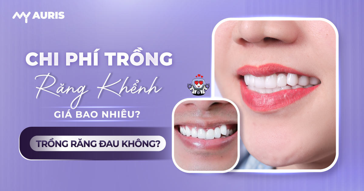 trồng răng khểnh,chi phí trồng răng khểnh
