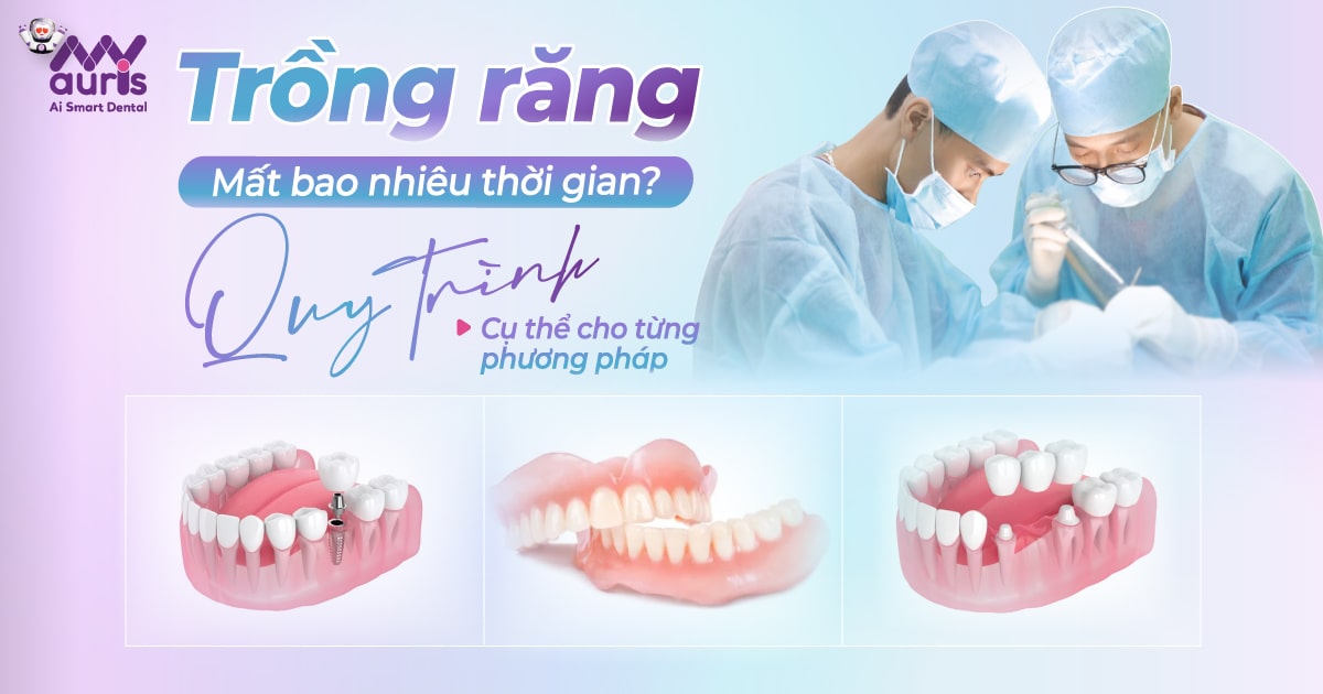 Trồng răng mất bao nhiêu thời gian