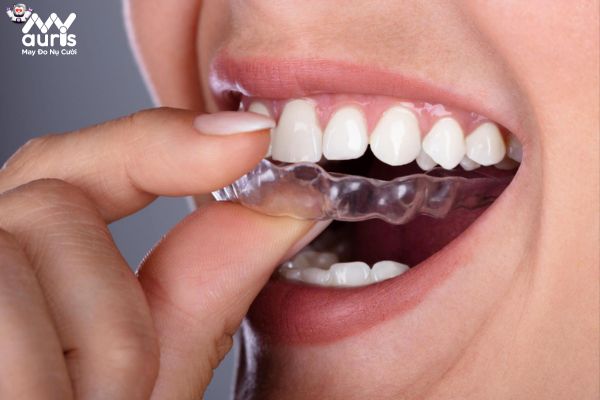 Chia sẻ của bác sĩ về việc trồng răng sứ rồi có niềng răng được không?