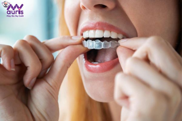Giải đáp câu hỏi: Bọc răng sứ có niềng răng được không?
