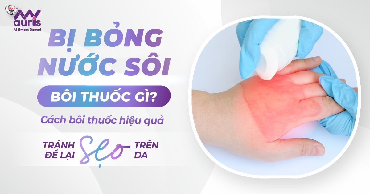 Bị bỏng nước sôi bôi thuốc gì - Cách bôi thuốc hiệu quả