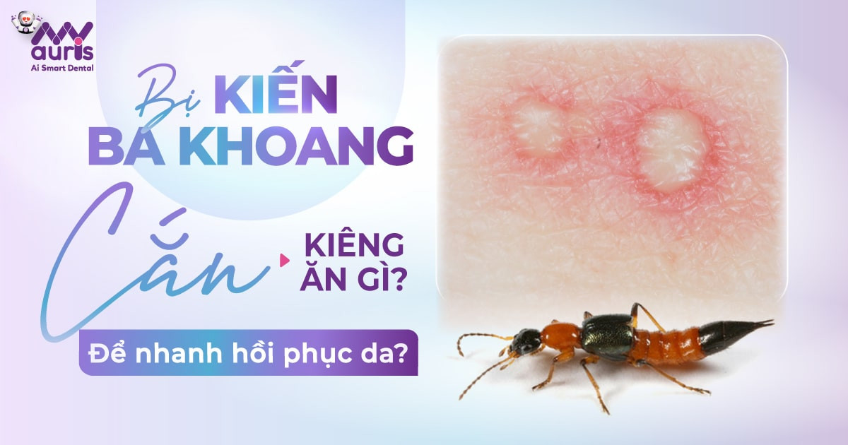 Bị kiến ba khoang cắn kiêng ăn gì để nhanh hồi phục da