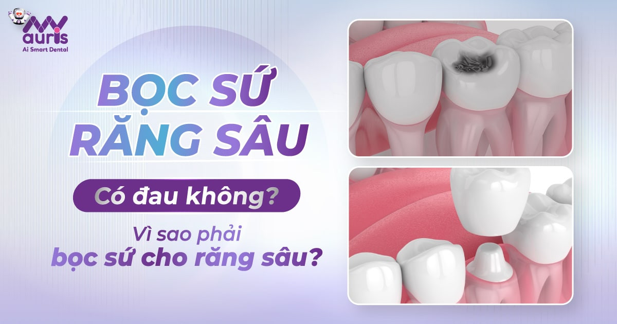 Bọc răng sứ sâu có đau không