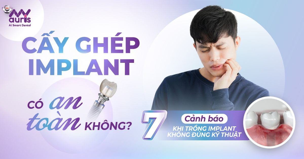 Cấy ghép implant có an toàn không - Cảnh báo 7 biến chứng