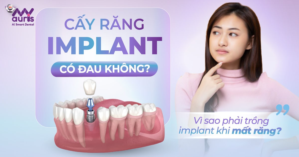 Cấy răng implant có đau không - Thời gian hồi phục