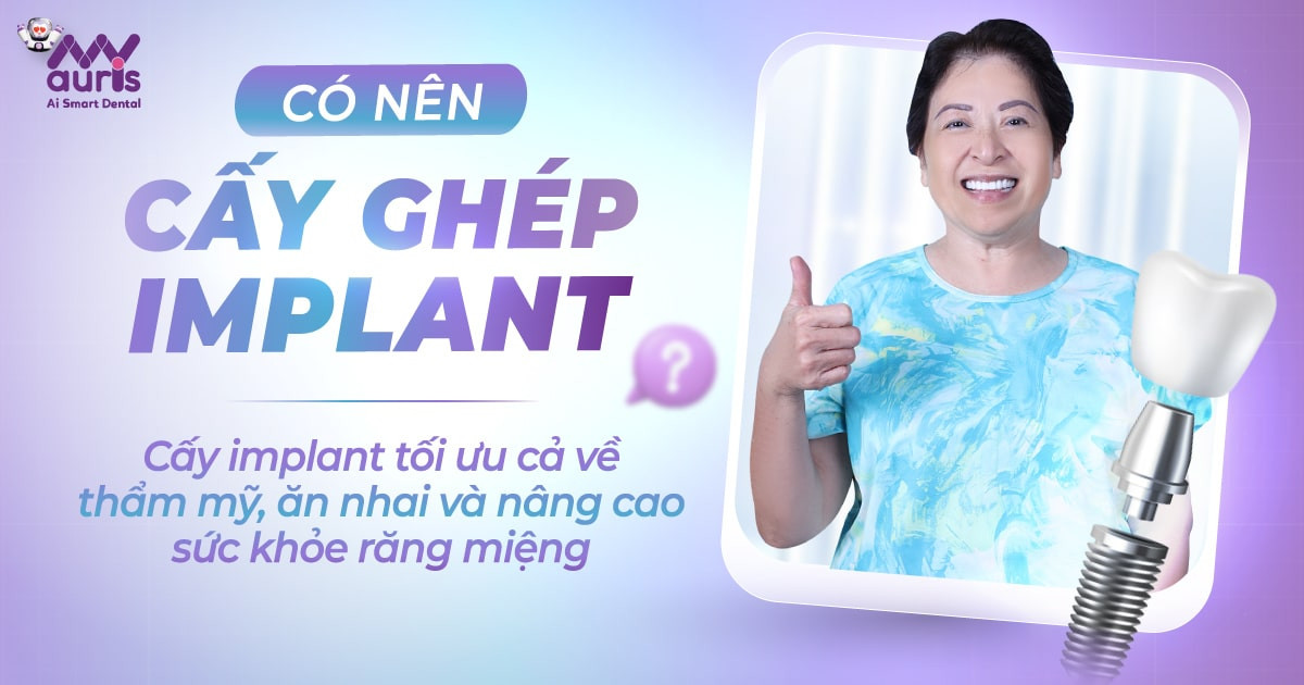 Có nên cấy ghép implant - Vì sao cấy implant tối ưu