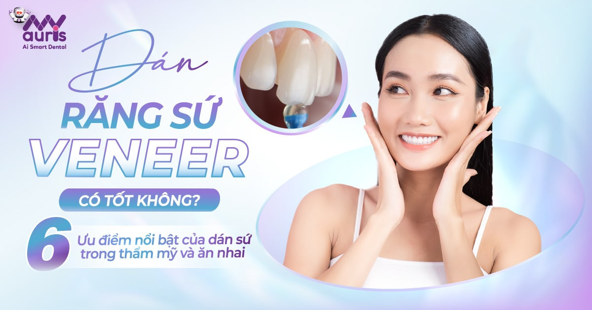 Dán răng sứ veneer có tốt không - 6 ưu điểm nổi bật