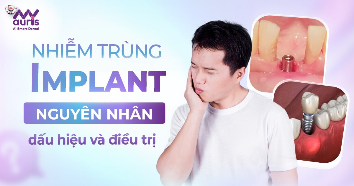 Nhiễm trùng implant Nguyên nhân, dấu hiệu và điều trị