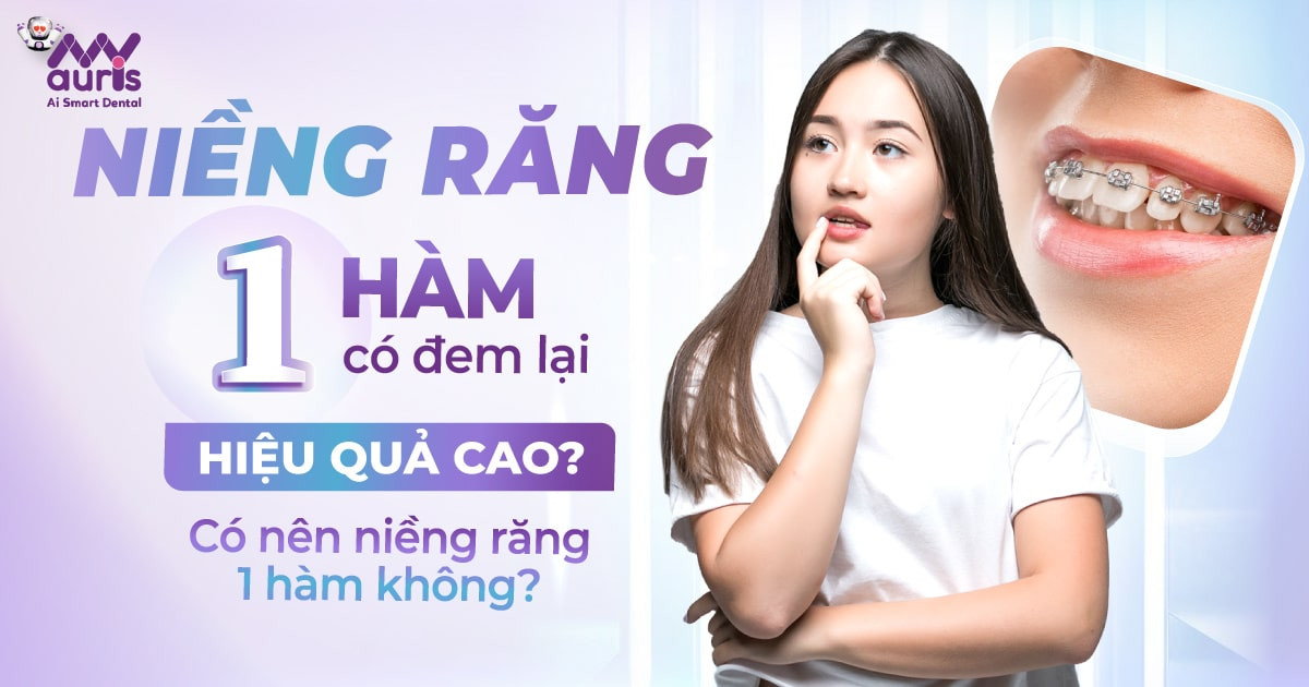 Niềng răng 1 hàm có đem lại hiệu quả cao (2)