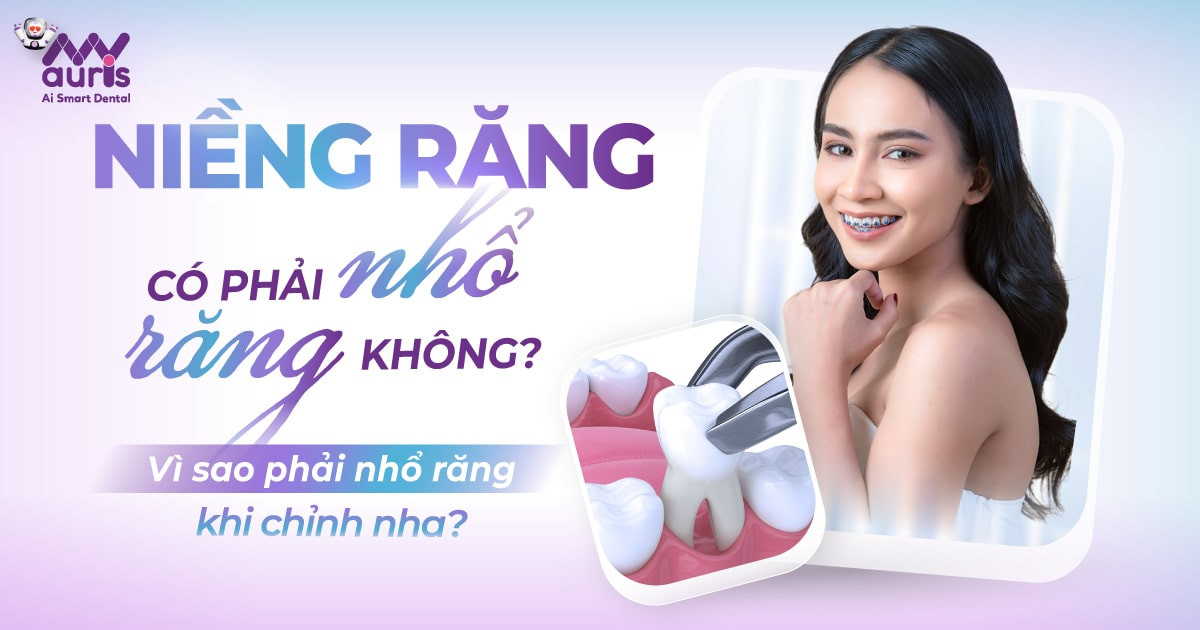 Niềng răng có phải nhổ răng không - Vì sao phải nhổ