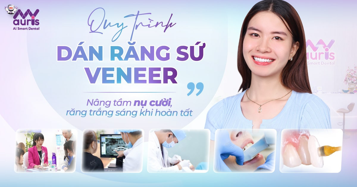 Quy trình dán răng sứ veneer - Nâng tầm nụ cười