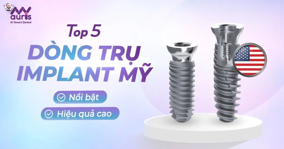 TOP 5 dòng trụ implant mỹ nổi bật, hiệu quả cao