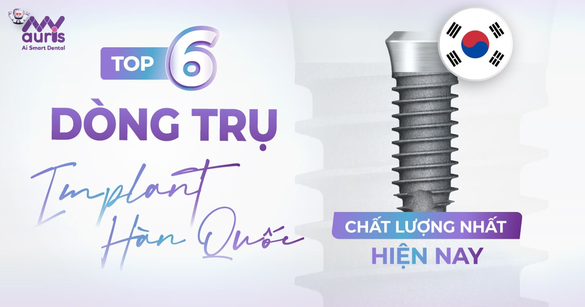 TOP 6 dòng trụ implant hàn quốc chất lượng nhất hiện nay