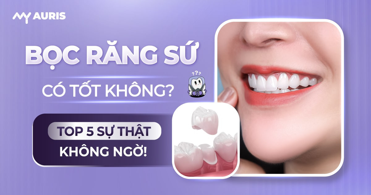 bọc răng sứ có tốt không,bọc răng sứ có bền không,bọc răng sứ thời gian được bao lâu,làm răng sứ có tốt không,trồng răng sứ có tốt không