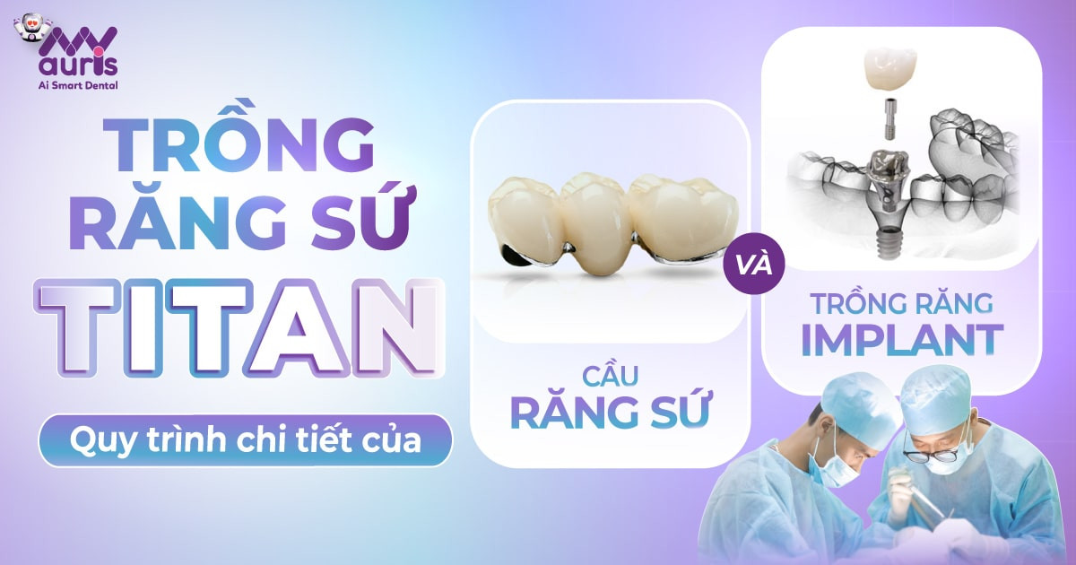 Cách trồng răng sứ Titan theo 2 phương pháp chính