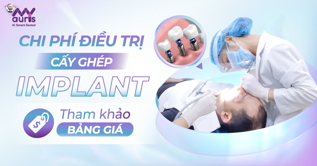 [Giải đáp nha khoa] Chi phí điều trị cấy ghép Implant