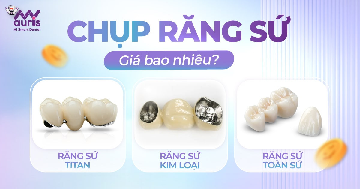 Chụp răng sứ giá bao nhiêu cho 3 dòng răng sứ chính?