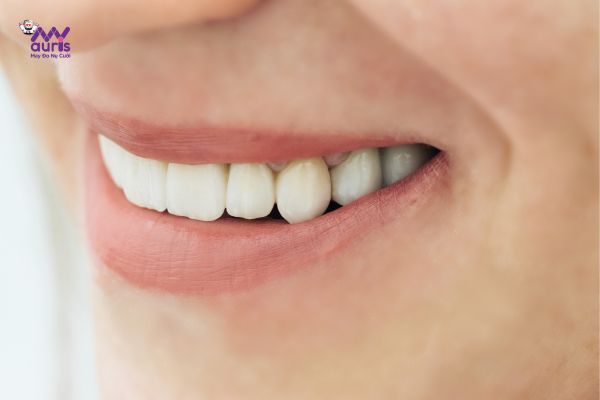 răng sứ cercon thường 