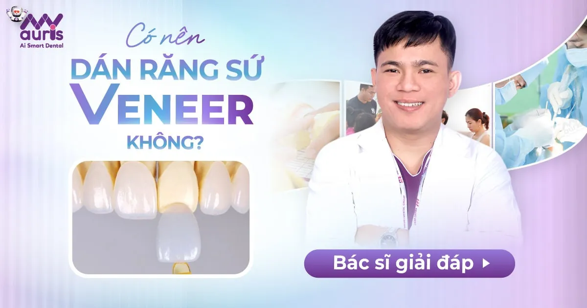 [Tư vấn nha khoa] Có nên dán răng sứ Veneer không?