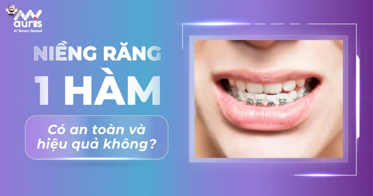 [Tư vấn nha khoa] Có niềng răng 1 hàm được không?