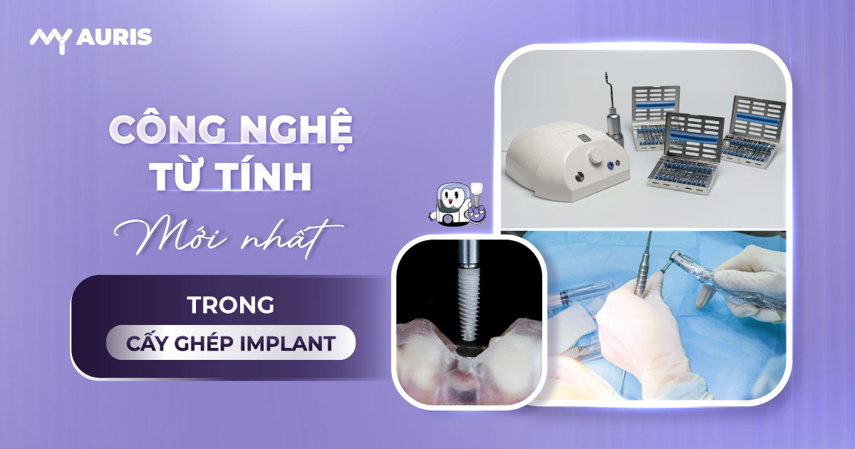 công nghệ từ tính trong cấy ghép implant,công nghệ cấy ghép implant
