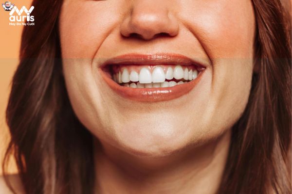 Chất liệu răng sứ nào tốt nhất?