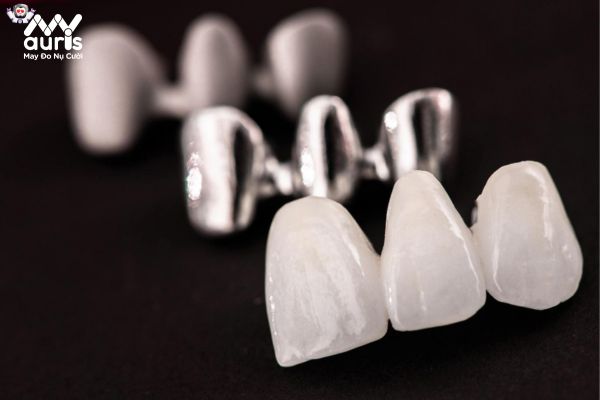 Các loại răng sứ phổ biến trong dịch vụ thẩm mỹ nha khoa