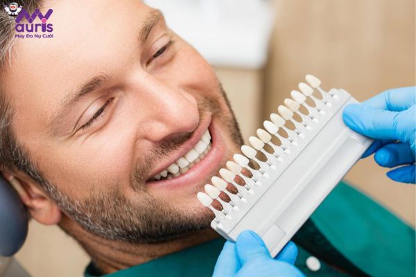 Những yếu tố quan trọng cần có trong quy trình dán răng sứ Veneer