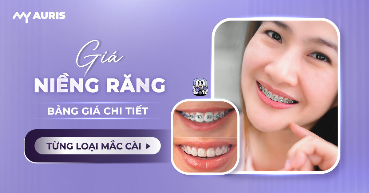 giá niềng răng,chi phí niềng răng,niềng răng bao nhiêu tiền,niềng răng giá rẻ,niềng răng giá bao nhiêu,niềng răng giá,niềng răng hết bao nhiêu tiền
